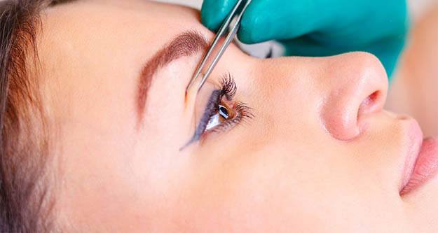 Göz kapağı ameliyatı nasıl yapılır?