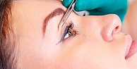 Göz kapağı ameliyatı nasıl yapılır?