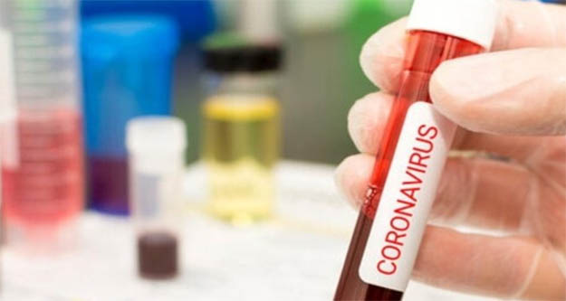 Koronavirüs nedeniyle bugün 193 kişi daha  hayatını kaybetti