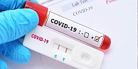 Koronavirüste bugün: 174 bin 443 testten 30 bin 103'ü pozitif çıktı