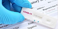 Koronavirüs nedeniyle bugün  168 kişi daha hayatını kaybetti