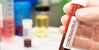 Koronavirüs nedeniyle bugün 193 kişi daha  hayatını kaybetti