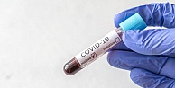 Koronavirüs  nedeniyle bugün 202 kişi daha hayatını kaybetti