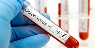 Koronavirüs nedeniyle bugün 97 kişi daha hayatını kaybetti