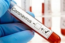 Koronavirüs nedeniyle bugün 97 kişi daha hayatını kaybetti