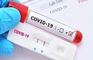 Koronavirüste bugün: 174 bin 443 testten 30 bin...