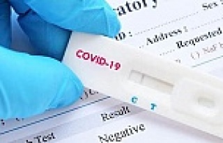 Koronavirüste bugün: 259 kişi daha hayatını kaybetti