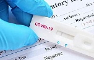Koronavirüs nedeniyle bugün 168 kişi daha hayatını...